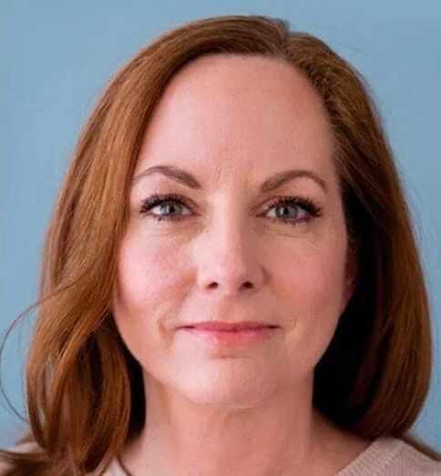 Après avoir utilisé la crème ZXCVBNQWERT, le visage de Joanna est transformé