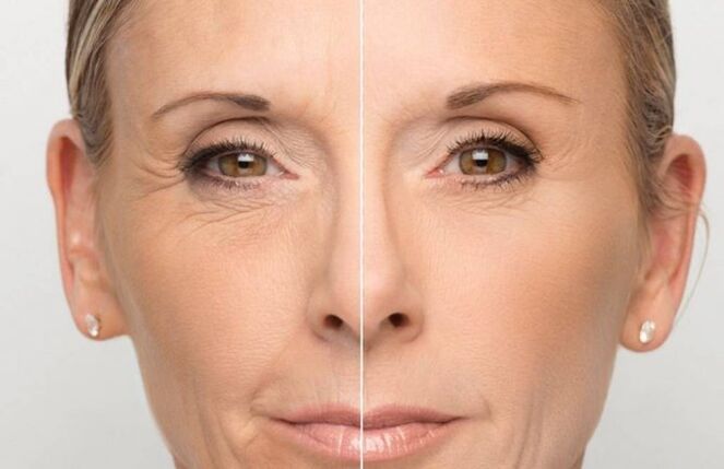 Peau du visage avant et après rajeunissement avec des masques