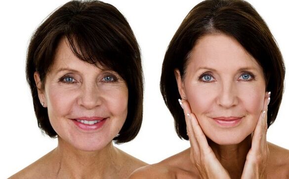 avant et après le rajeunissement de la peau du visage à la maison